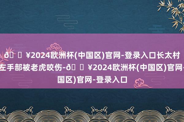 🔥2024欧洲杯(中国区)官网-登录入口长太村又名村民左手部被老虎咬伤-🔥2024欧洲杯(中国区)官网-登录入口